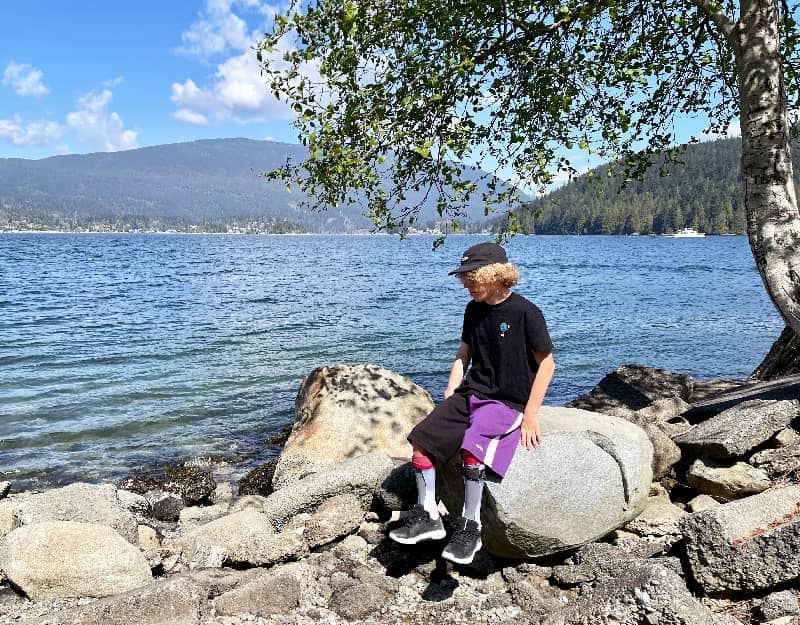 Scott sitting on a rock by the ocean. He is wearing a ball-cap, black t-shirt, purple shorts, and braces on his legs. The sky is clear and the water is choppy.